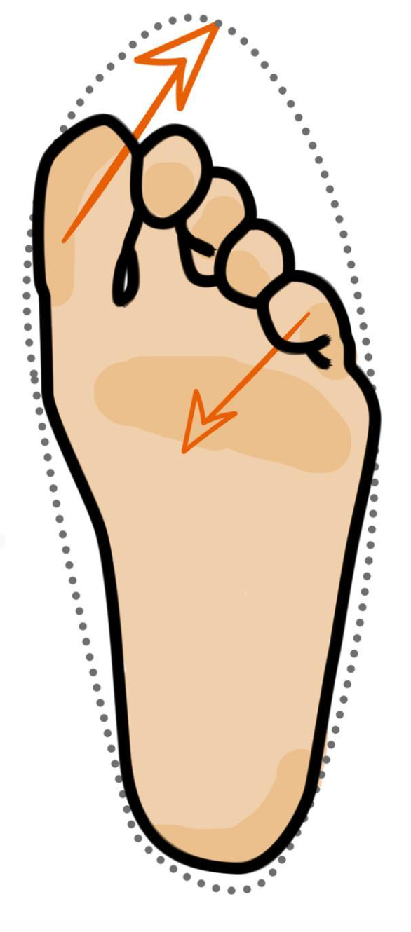 Compressed toes